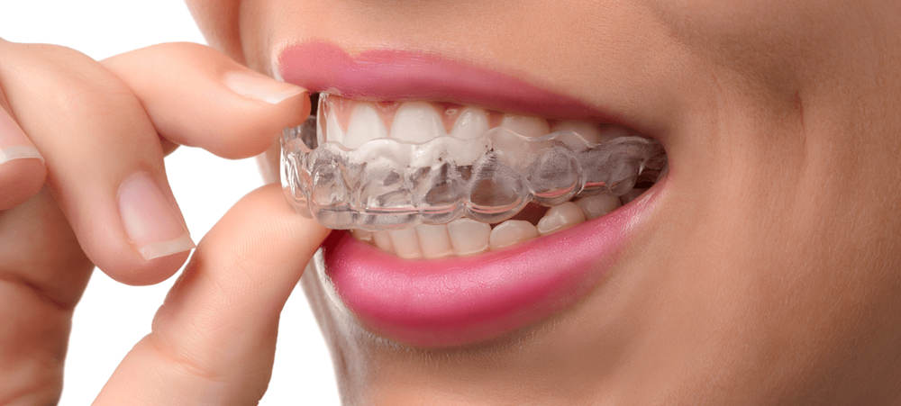 10 Best Invisalign Orthodontists in Dubai (Prices & Reviews)